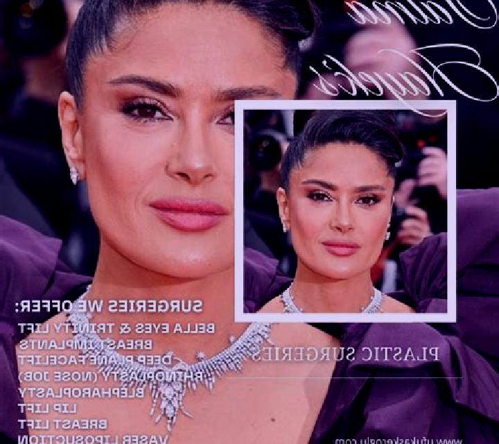 Renata 3 Abalcisqueta escort
